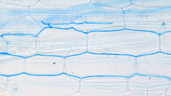 Image of endophyte found in grass. Researchers discovered safer endophytes in grass, helping reduce the risk of ryegrass staggers in livestock.