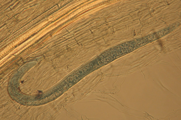 31 Female lesion nematode with egg WC 13mth