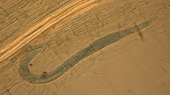 Image of nematode. Science has helped tackle drench resistance in livestock, including through a DNA-based method to identify nematode larvae to species level.